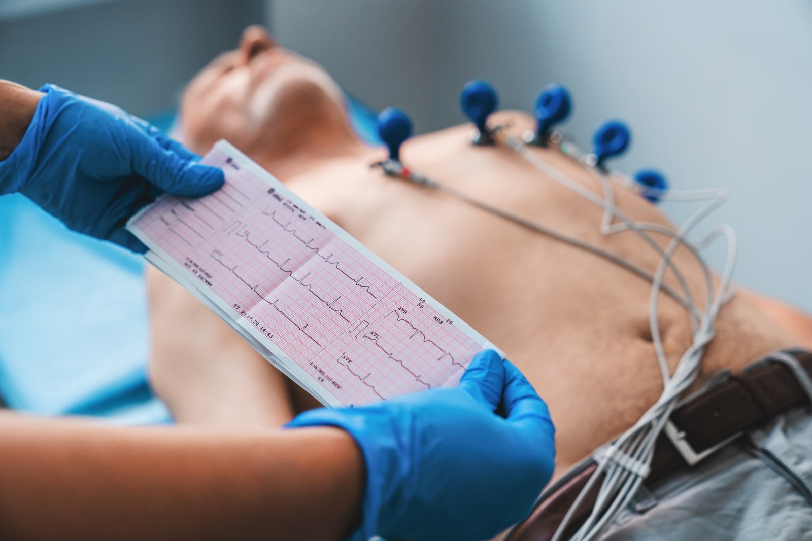 electrocardiogram-ecg-in-hand-cardiogram-printout-on-male-patient-background